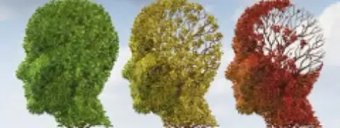 Idegsejtek beültetésével válhat gyógyíthatóvá az Alzheimer-kór