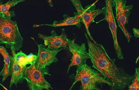 Az optikai mikroszkóptól a nanoszkópig
