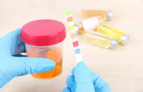 Egészen korai fázisában kimutatható lehet az Alzheimer-kór