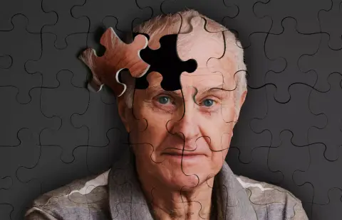 Talán nem is az agyban kezdődik az Alzheimer-kór