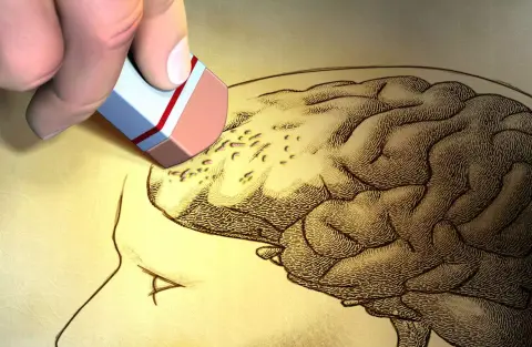 Vírusfertőzés állhat az Alzheimer-kór hátterében?