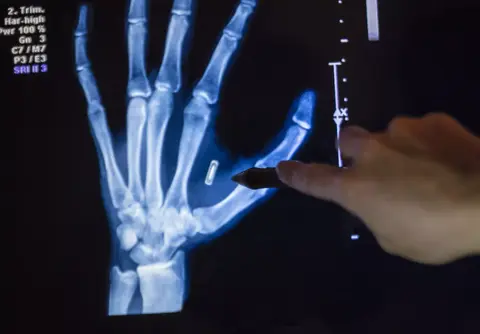Mikrochip beléptetőkártya helyett?