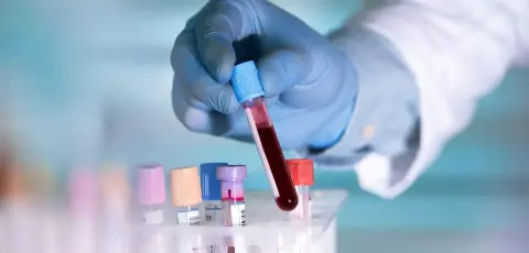 Évekkel a tünetek jelentkezése előtt kimutatható lehet az Alzheimer-kór egyik formája