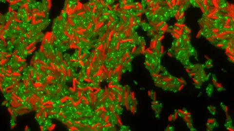 Két óra alatt ellenállóvá válhatnak egy antibiotikummal szemben a baktériumok