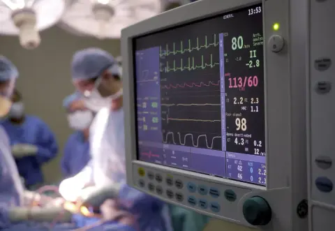 EKG-görbék alapján jósol túlélési esélyeket egy mesterséges intelligencia