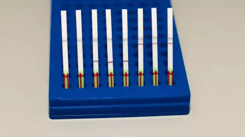 CRISPR-alapú tesztekkel gyorsulhat fel a SARS-CoV-2 fertőzöttek azonosítása