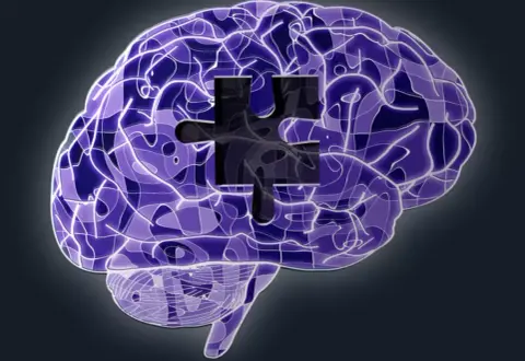 Alzheimer-kór, gépi tanulás és gamifikáció