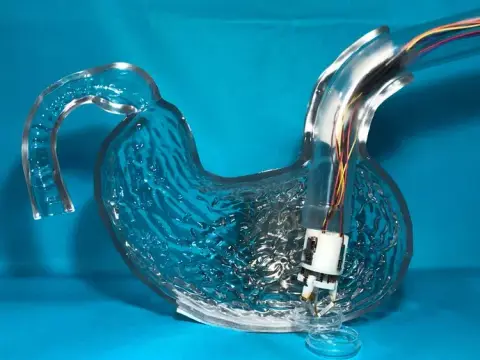 Testen belüli 3D nyomtatással foltozhatják be a gyomorfekélyeket