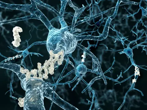 Alakváltó fehérje segíthet az Alzheimer-kór titkainak megfejtésében