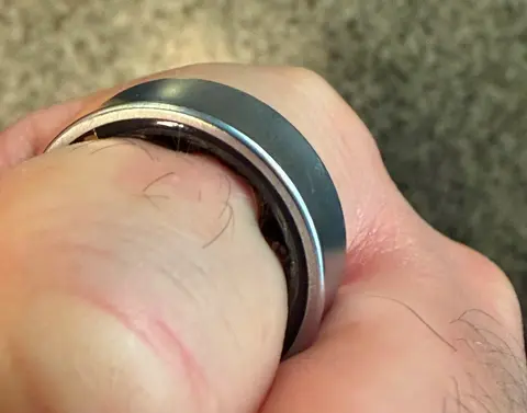 Nagy a baj a Galaxy Ring okosgyűrűvel, egy felhasználó ujjáról a kórházban kellett levenni