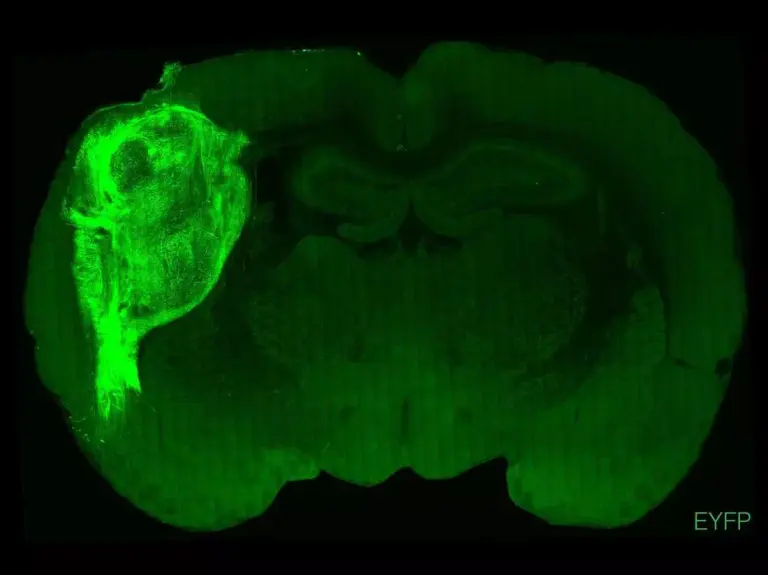 Galéria megnyitása